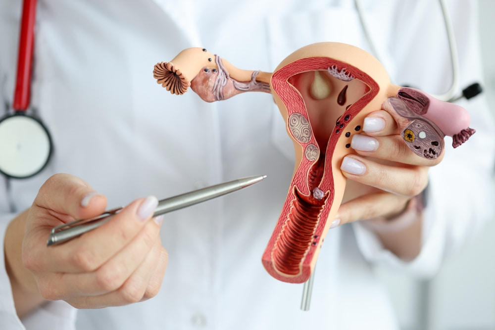 O que é o rejuvenescimento ovariano e por que não funciona?