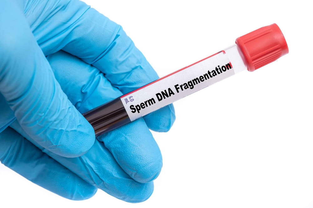 Fragmentação do DNA Espermático