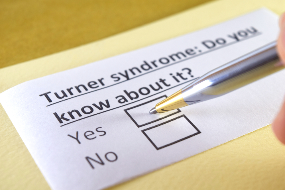 Síndrome de Turner: O que é, causas, sintomas e infertilidade