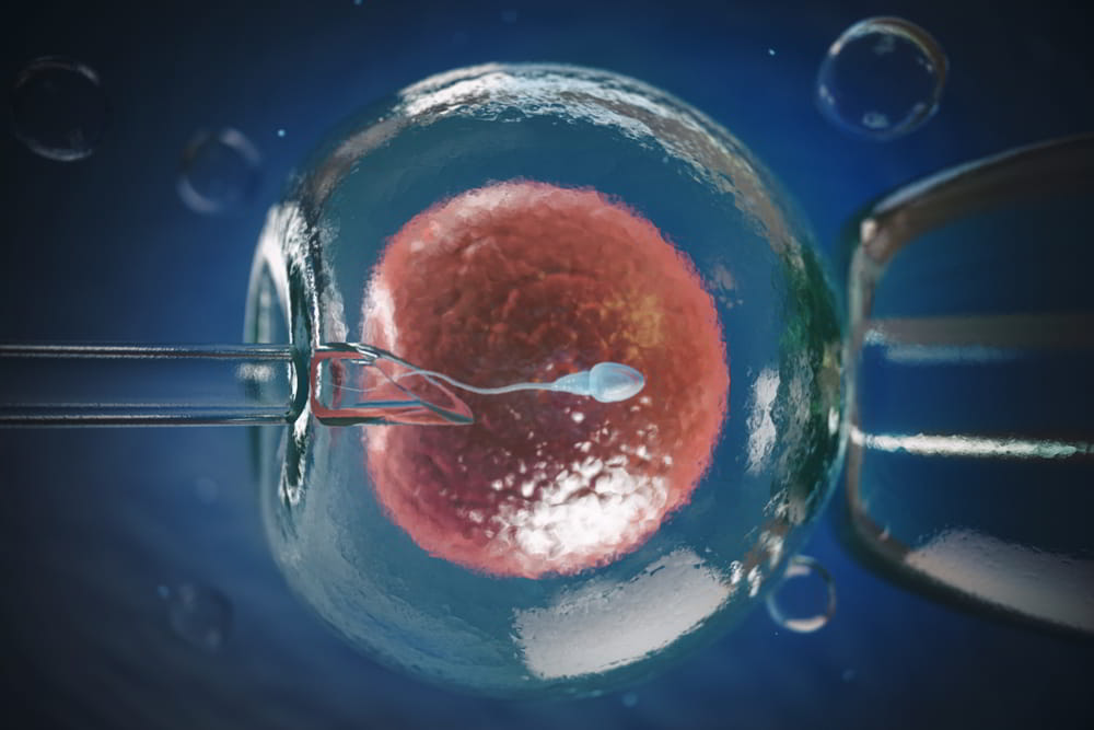 FIV (Fertilização in Vitro): o que é e como funciona