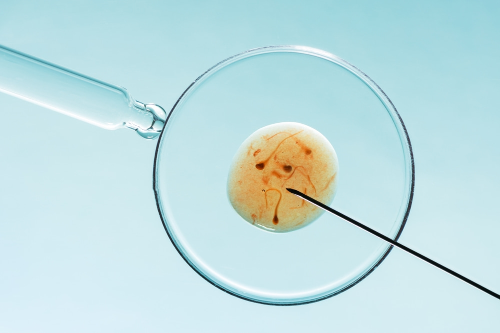 Testes genéticos na FIV: quais fazer?