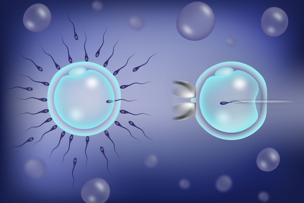 FIV clássica e FIV por ICSI: quais as diferenças?
