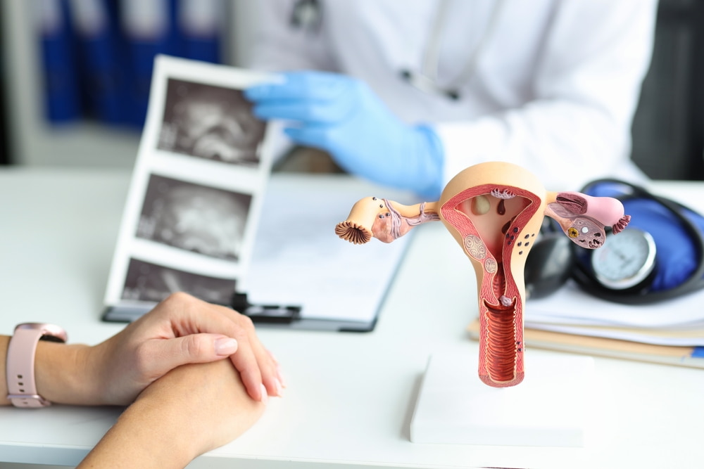 Mioma intramural: o que é, sintomas e relação com a fertilidade