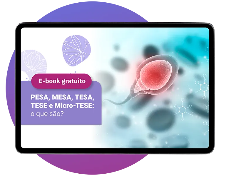 Ebook
