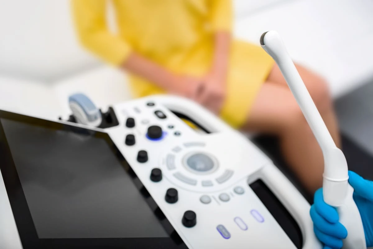 Como funciona o monitoramento dos folículos na FIV?